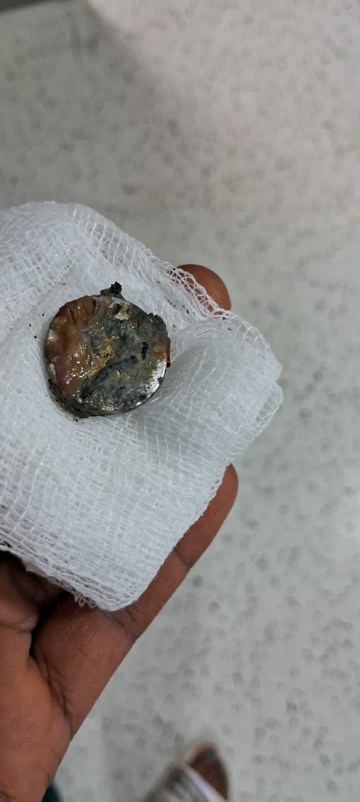 Dr M Mahesh Singh Yukti Liver and Gastrocare Bilaspur CG 1