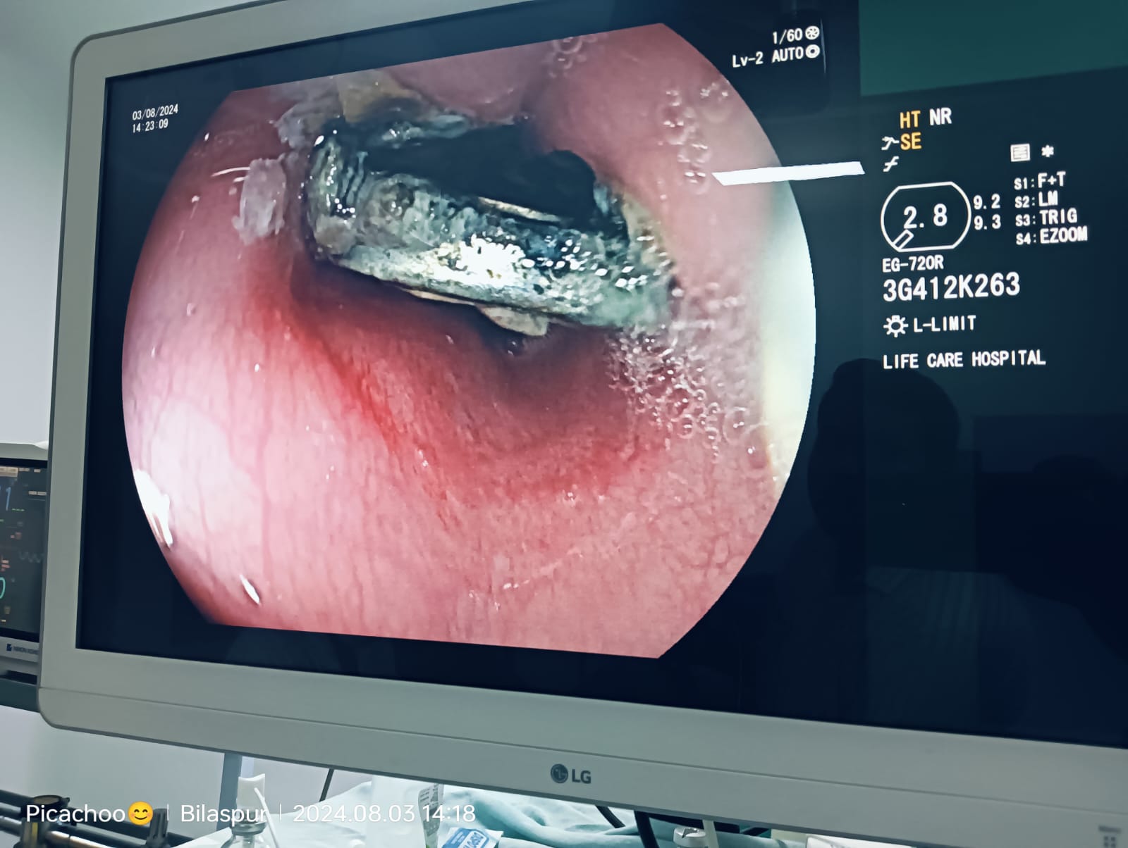 Dr M Mahesh Singh Yukti Liver and Gastrocare Bilaspur CG