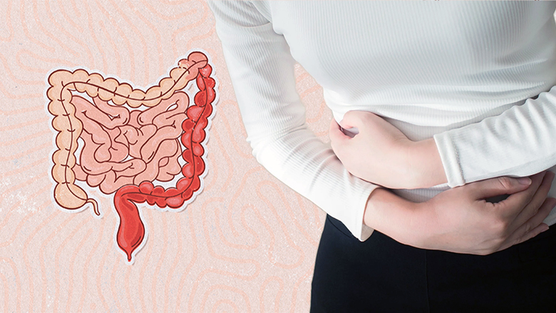 Ulcerative Colitis Treatment in Bilaspur